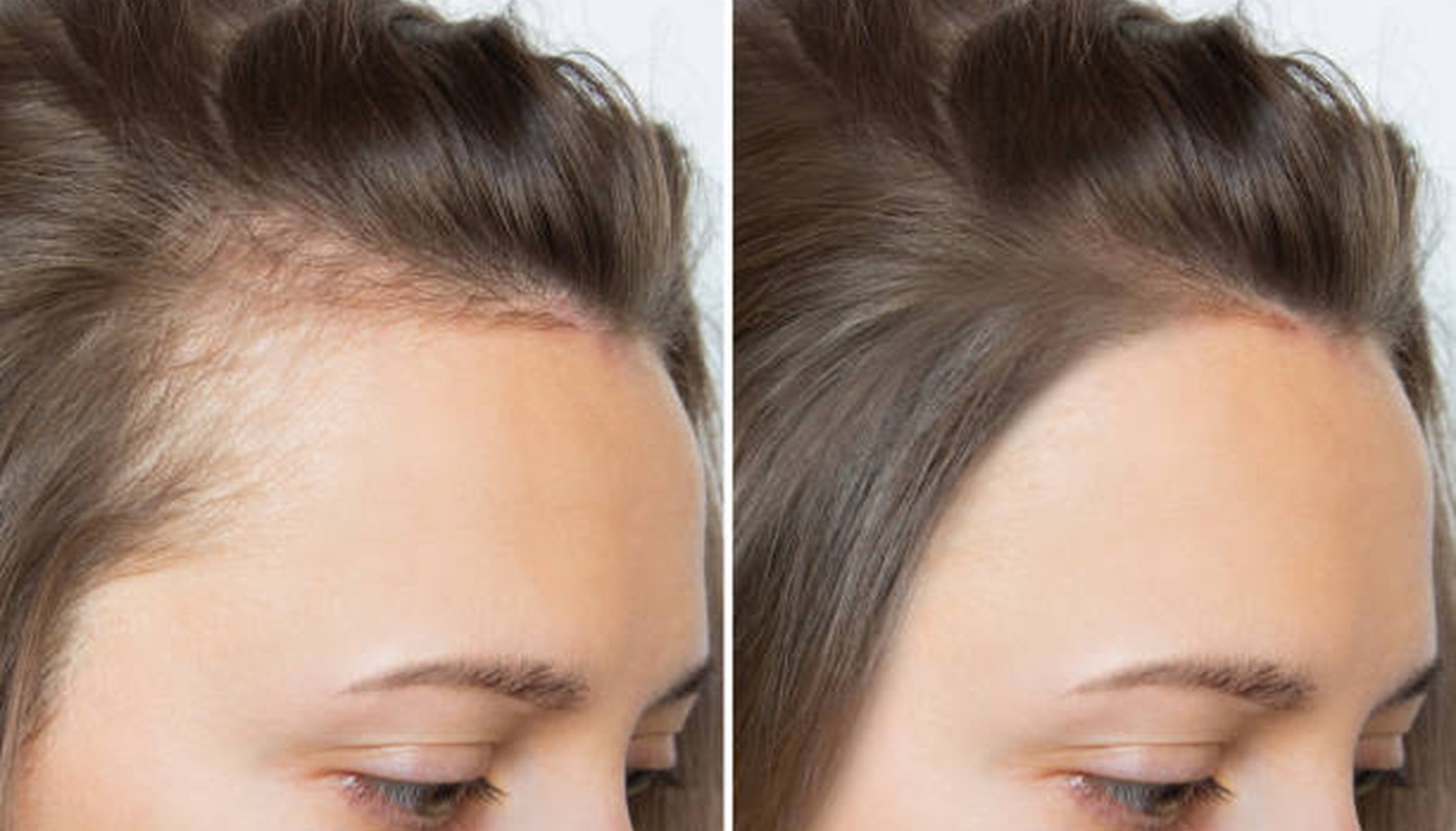 Hair Growth guides