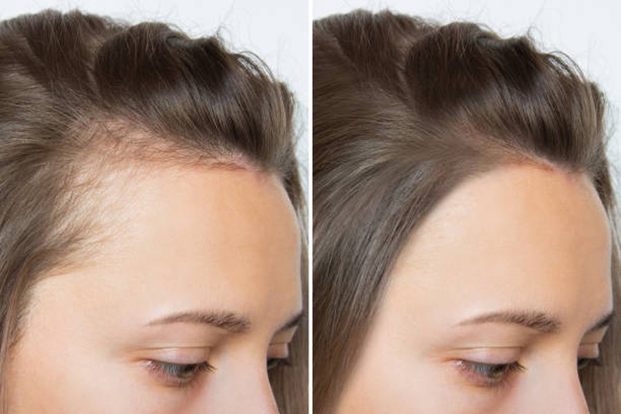 Healthy hair care